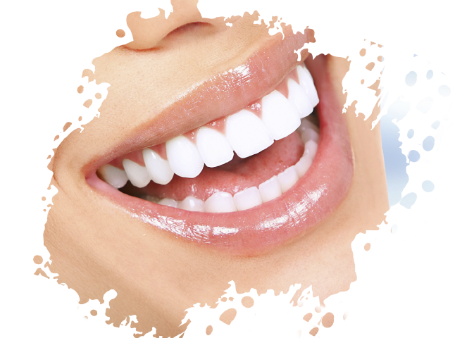 https://www.medicapro.com.tn/wp-content/uploads/2022/05/Blanchiment-des-dents-1.png