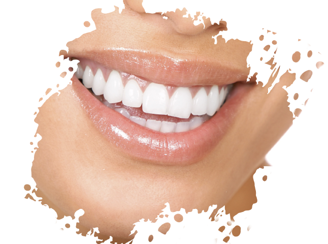 https://www.medicapro.com.tn/wp-content/uploads/2022/05/Couronne-Dentaire.png