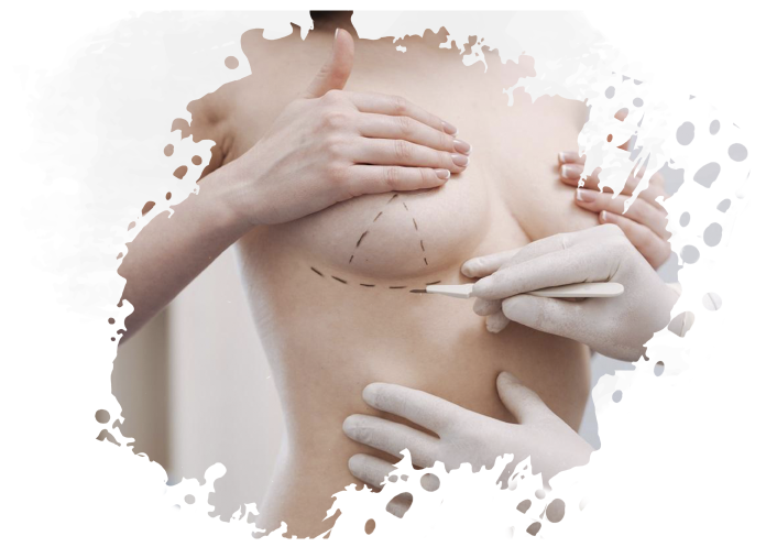 https://www.medicapro.com.tn/wp-content/uploads/2022/05/RECONSTRUCTION-DU-SEIN-PAR-PROTHESE.png
