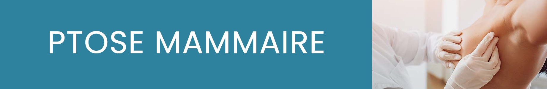 https://www.medicapro.com.tn/wp-content/uploads/2022/07/PTOSE-MAMMAIRE.jpg