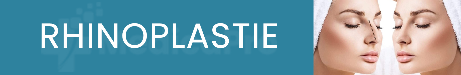 https://www.medicapro.com.tn/wp-content/uploads/2022/07/Rhinoplastie.jpg