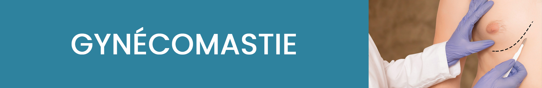 https://www.medicapro.com.tn/wp-content/uploads/2022/07/gynécomastie-1.jpg