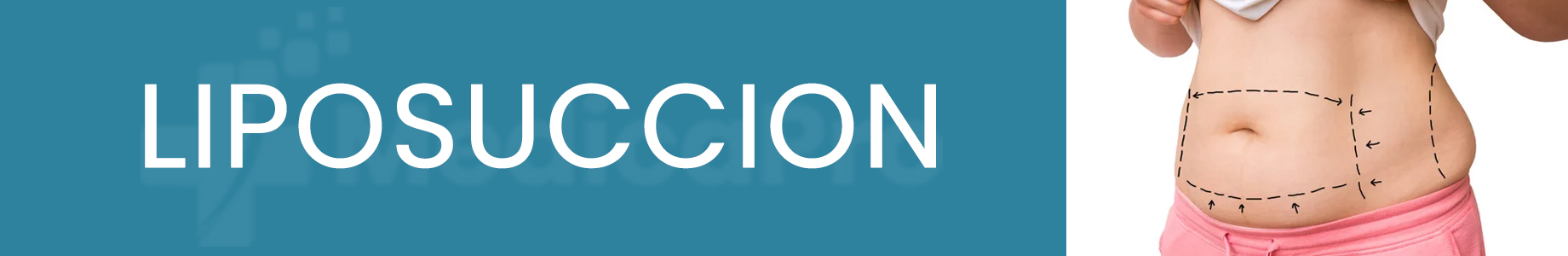https://www.medicapro.com.tn/wp-content/uploads/2022/07/liposuccion.jpg