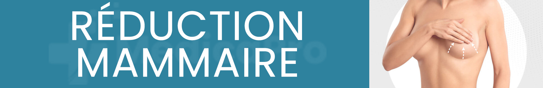 https://www.medicapro.com.tn/wp-content/uploads/2022/07/réduction-mammaire.jpg