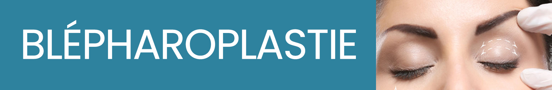 https://www.medicapro.com.tn/wp-content/uploads/2022/08/BLÉPHAROPLASTIE-1.jpg